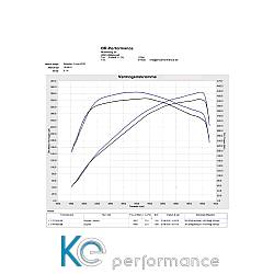 Eventuri Carbon Ansaugsystem für Honda Civic Type-R FK8 - 2836